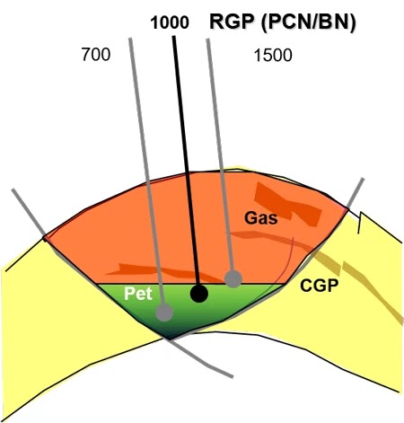 Productividad de un Nuevo Pozo - Esquemático RGP vs. Profundidad Esquemático de RGP vs. Profundidad.